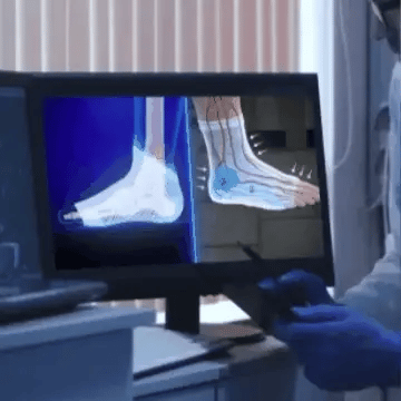 Medias De Compresión NeuroPress™ By SereniVida (Oferta 2x1)
